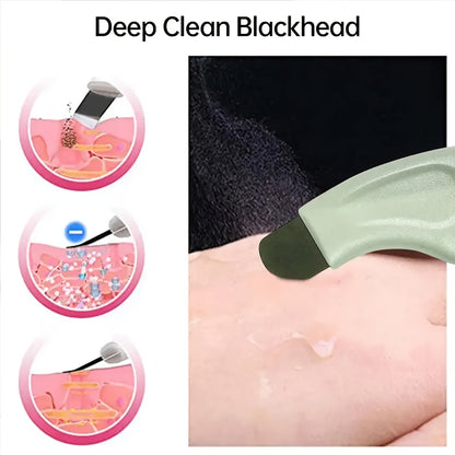 TSIEN BEAUTY Gentle Blackhead & Whitehead Remover Tool - Ergonomic, Manual Acne Extractor for Clearer Nose & Face Skin, Fragrance-Free Beauty Care Scrubber, Acne Extraction|Ergonomic Design|Smooth Texture