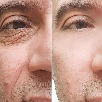 Retinol Anti-wrinkle Cream For Men Collagen Anti-Aging Removal Face Neck Wrinkle Efficient Moisturizing Firming Korean Skin Care