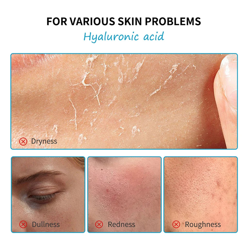 Skincare Mini Kit Cleanser Makeup Remover Moisturiser & Eye Cream For Hydrating Skin Airplane-Friendly Sizes Skincare Set