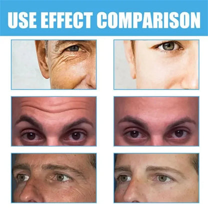 Retinol Anti-wrinkle Cream For Men Collagen Anti-Aging Removal Face Neck Wrinkle Efficient Moisturizing Firming Korean Skin Care