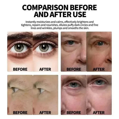 Retinol Anti-wrinkle Cream For Men Collagen Anti-Aging Removal Face Neck Wrinkle Efficient Moisturizing Firming Korean Skin Care